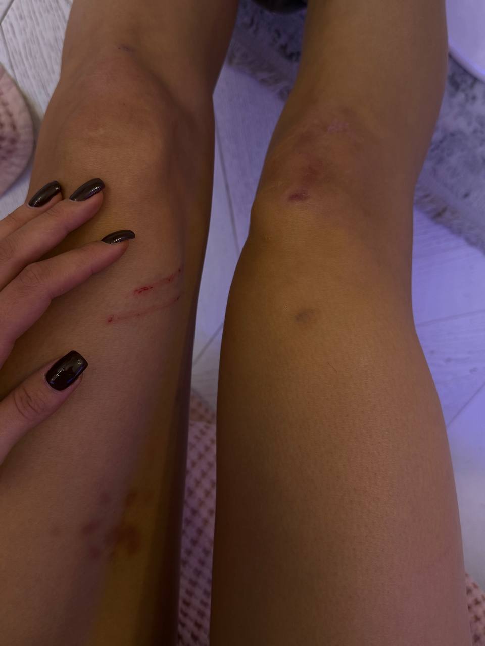 Валя Карнавал Photo #69