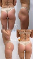 Хофманита Photo #28